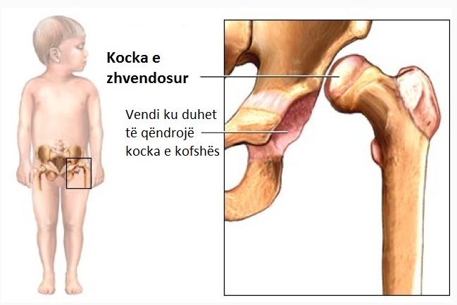 kocka 1